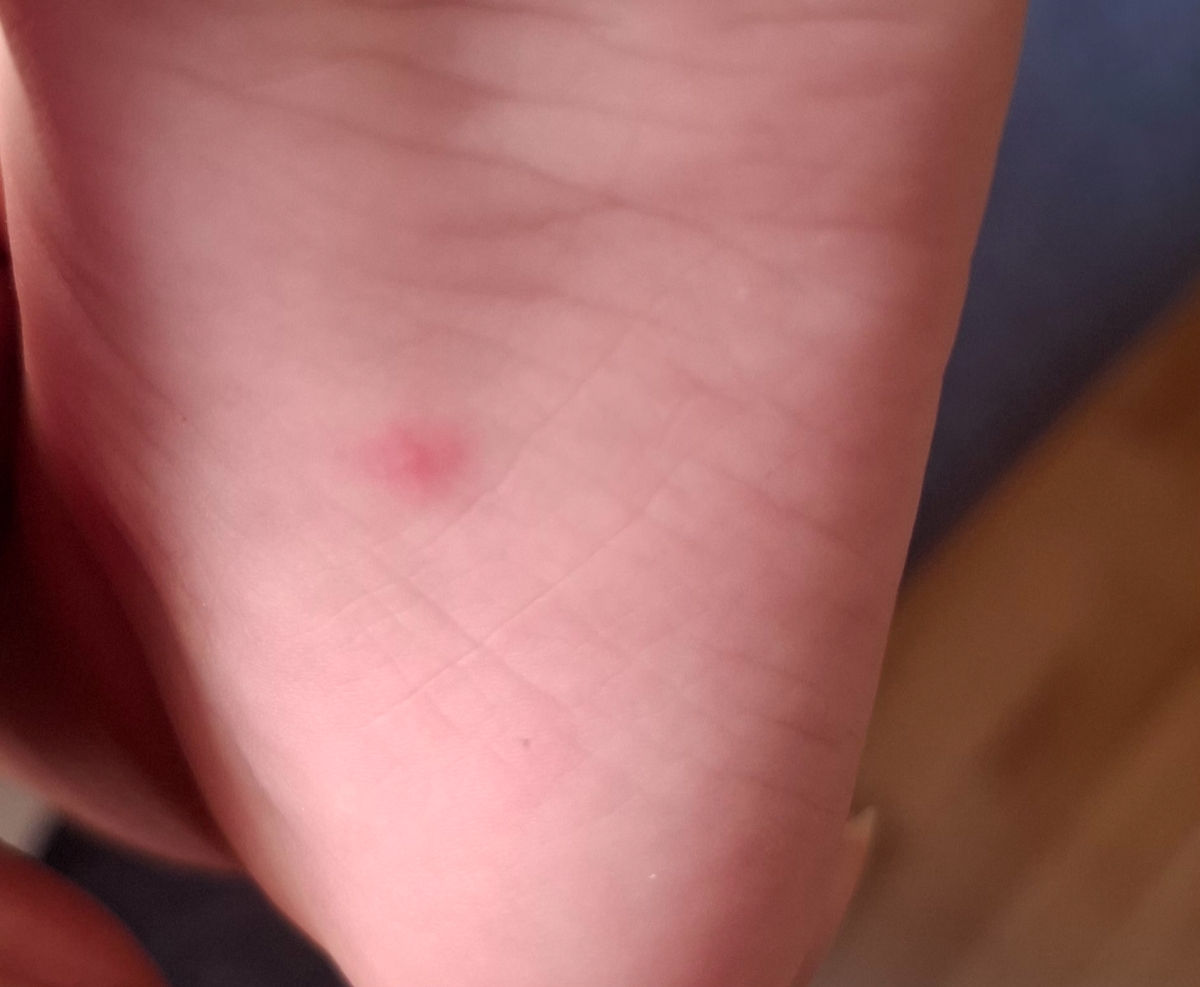 آیا اینا تبخاله؟همراه عکس آیا اینا تبخاله؟همراه عکس