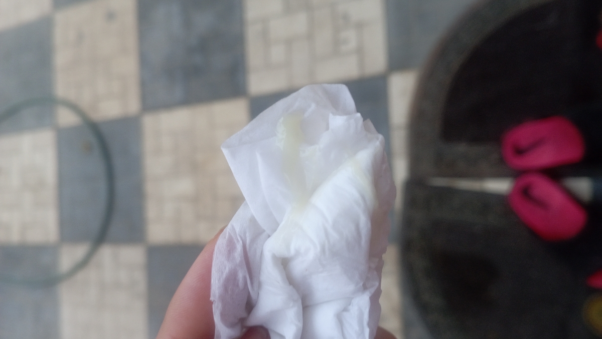 عفونت بارداری ترشحات سبز عفونت بارداری ترشحات سبز