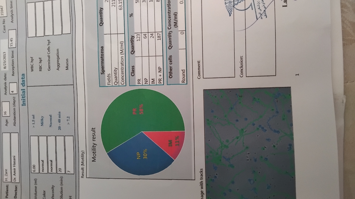 تفسیر آزمایش خودم و همسرم برای اقدام به بارداری تفسیر آزمایش خودم و همسرم برای اقدام به بارداری