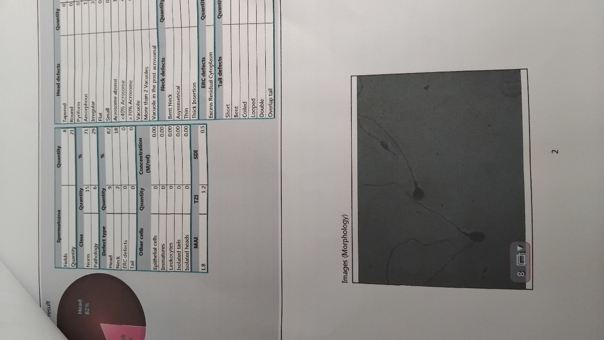 تفسیر آزمایش خودم و همسرم برای اقدام به بارداری تفسیر آزمایش خودم و همسرم برای اقدام به بارداری