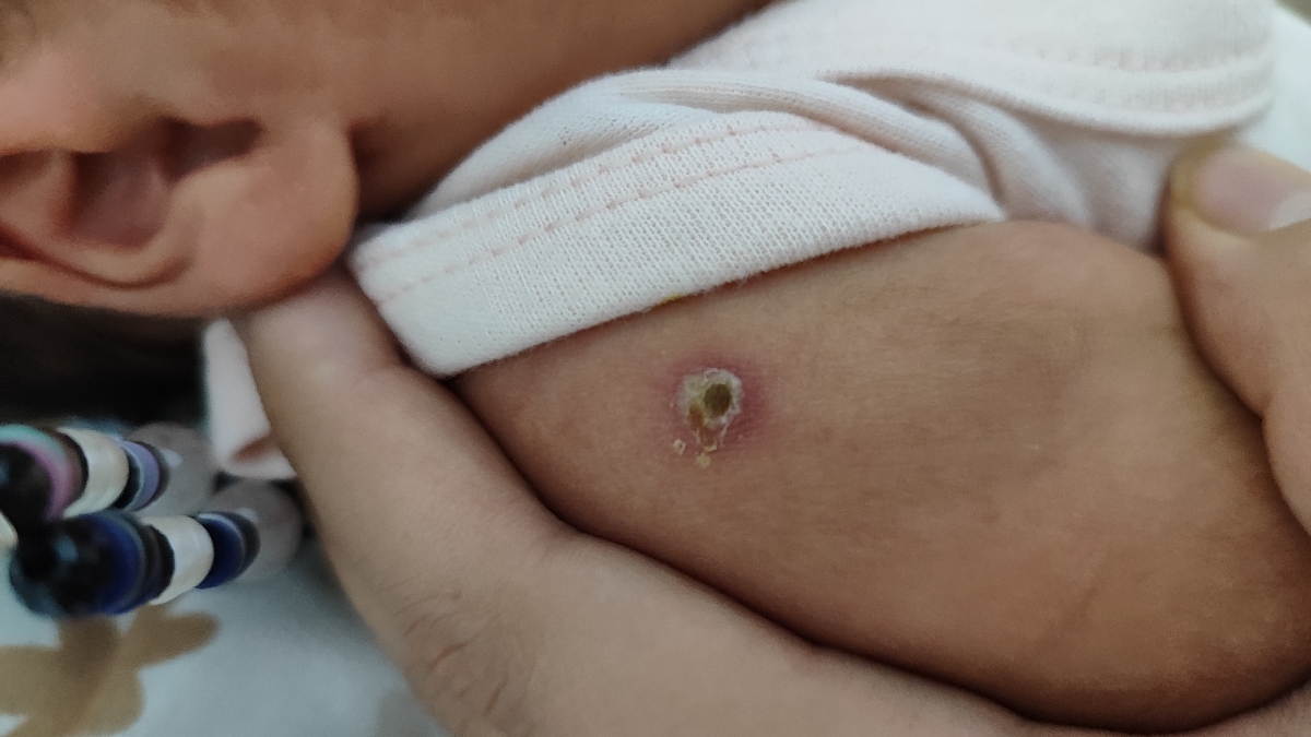 چرا اینطوری شده قبلاً فقط قرمز بود