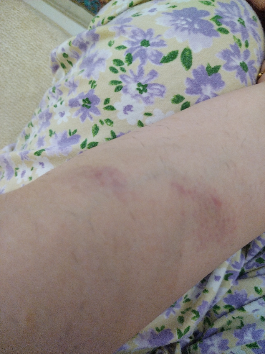 دکتر جان ازمایش های منو چک میکنید.