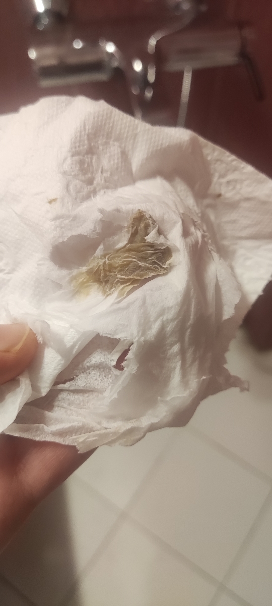 دفع ترشح زیاد در بارداری