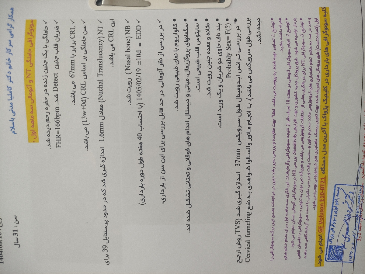 تفسیر سونوی ان تی