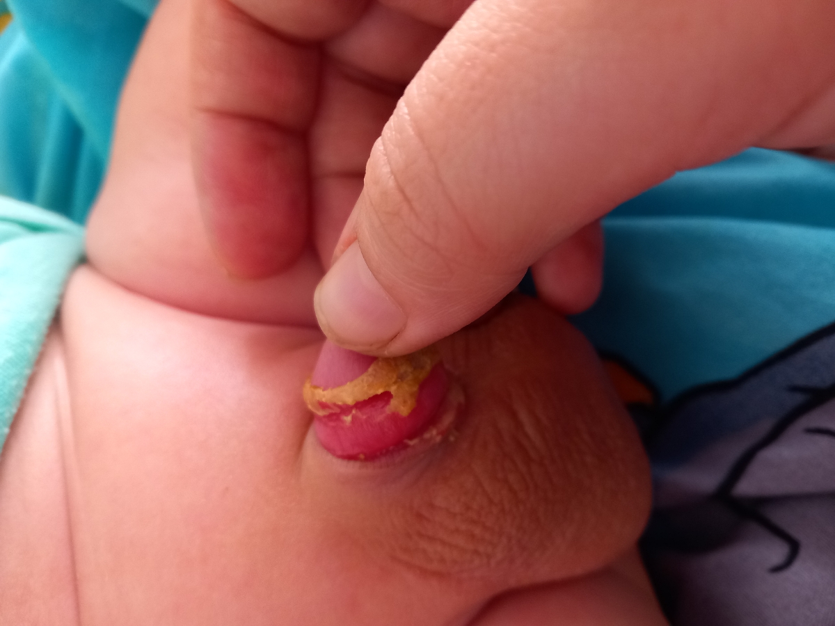 اینور اینطوری ورم کرده 