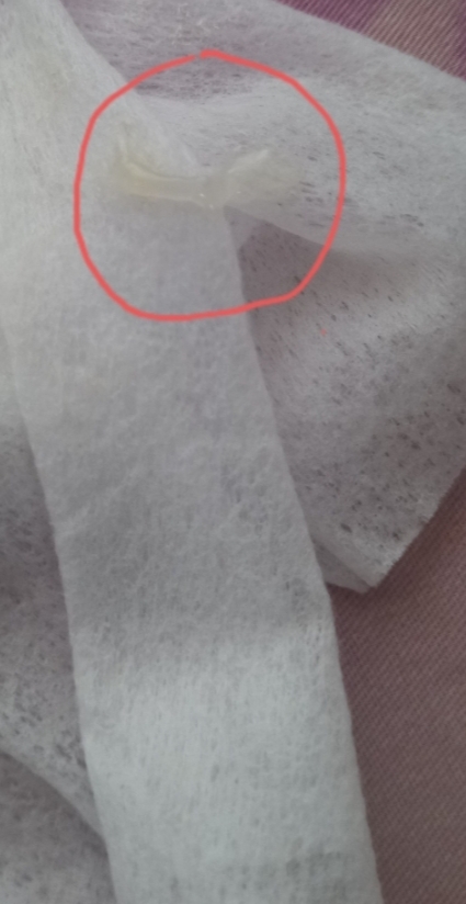 ترشح از واژن نوزاد ده روزه +عکس