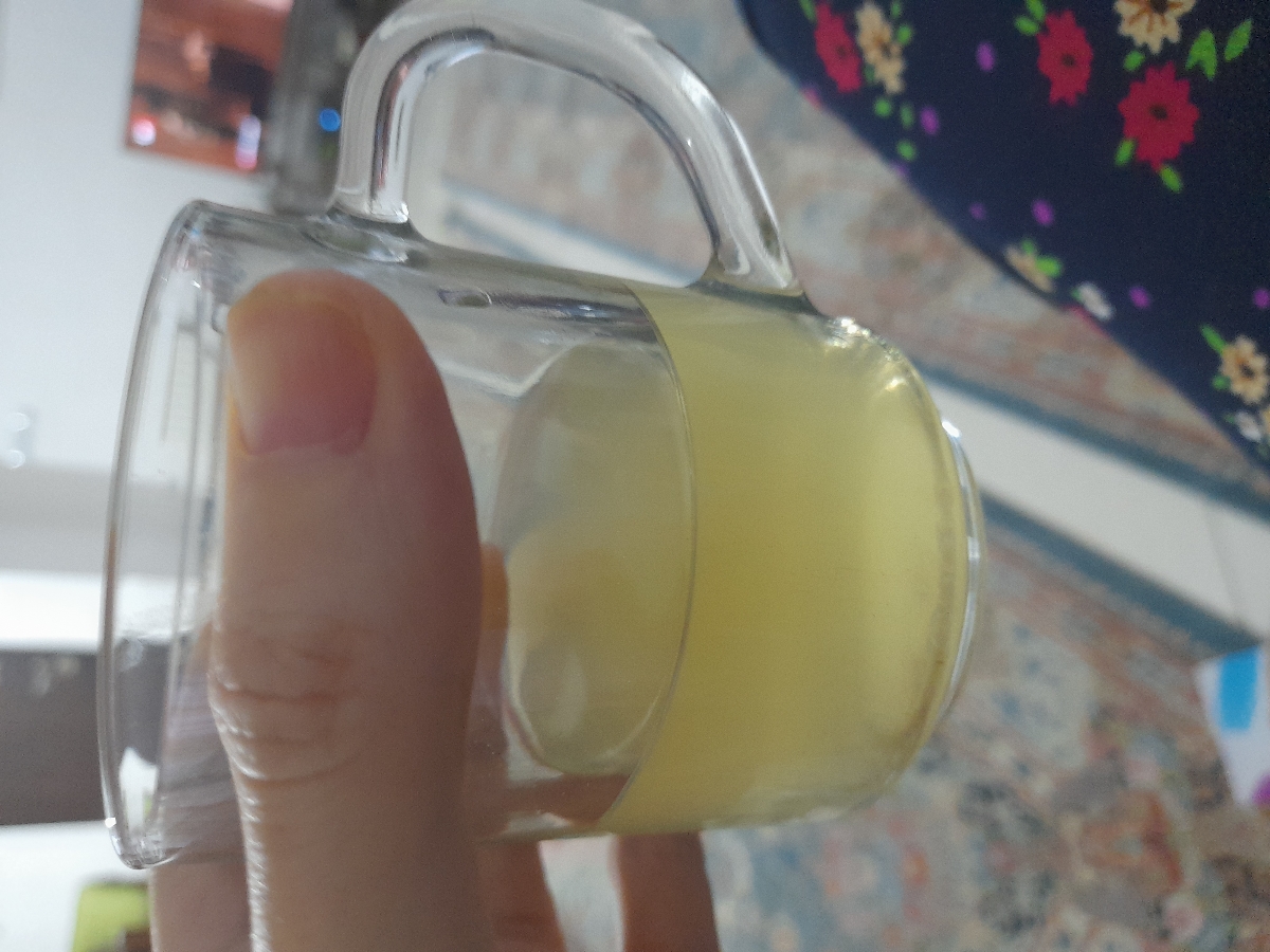 پارگی کیسه آب بارداری