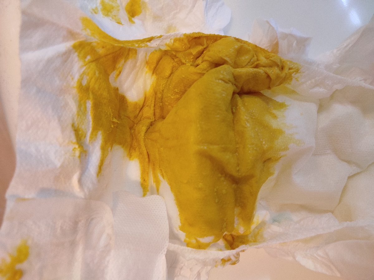 مدفوع نوزاد دو ماهه