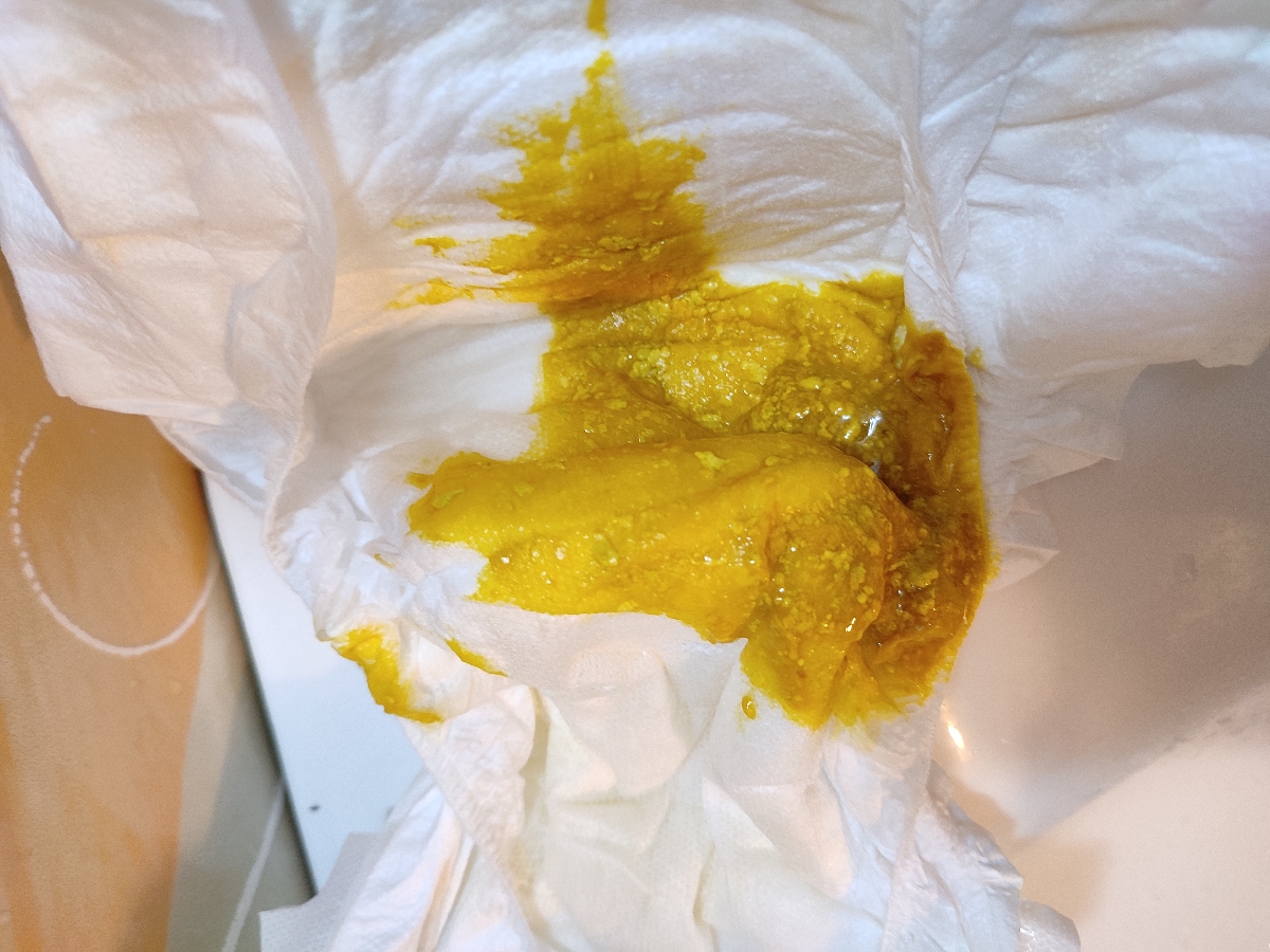 مدفوع نوزاد دو ماهه