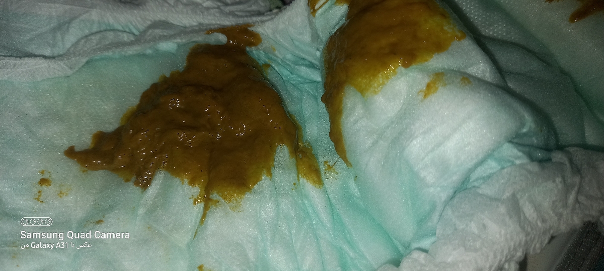 یبوست و مدفوع خلطی .... یبوست و مدفوع خلطی ....