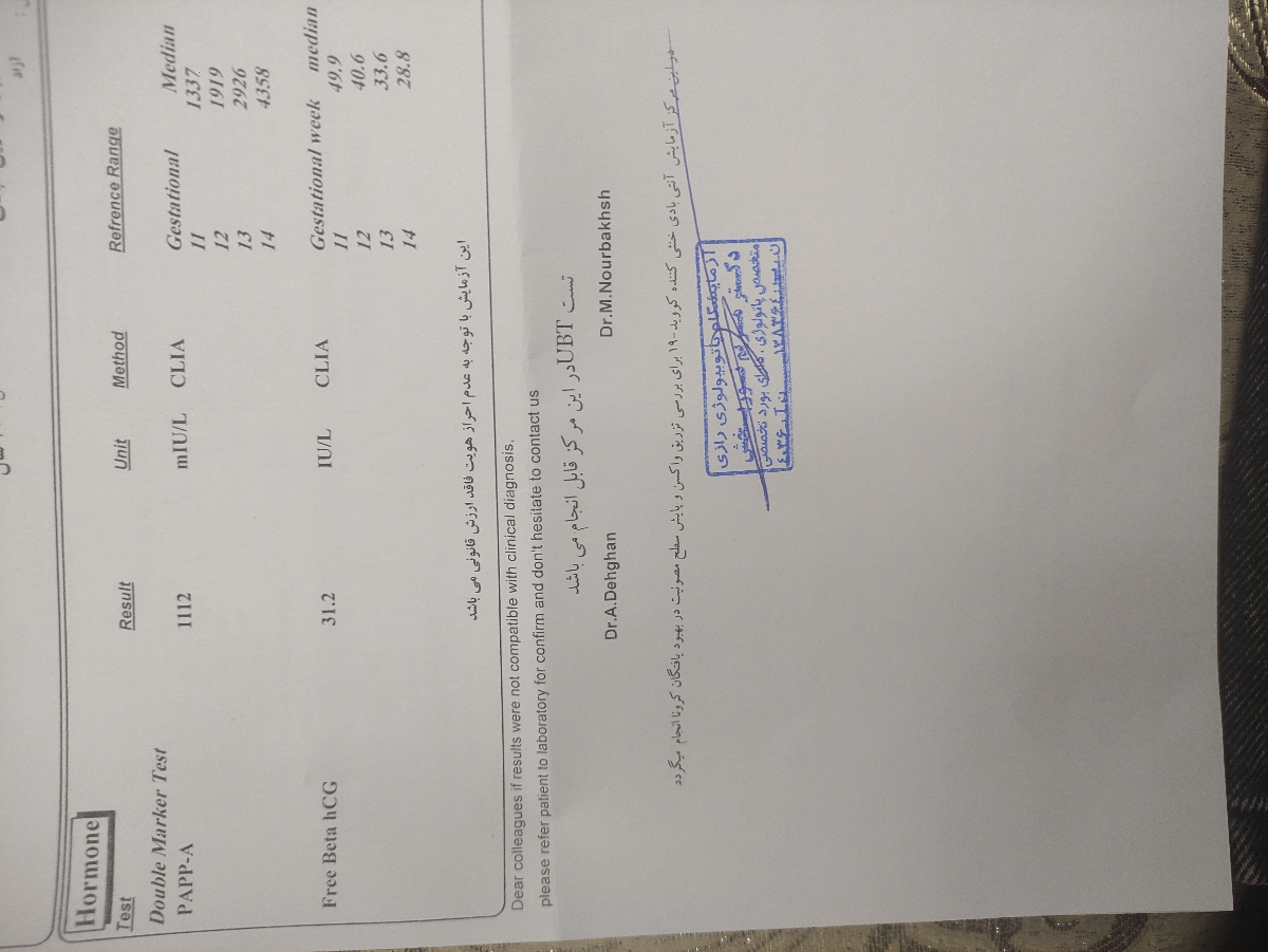 تفسیر سونوی ان تی