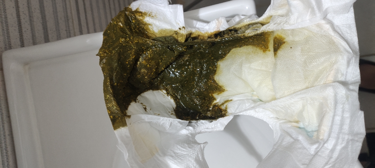 عذرخواهی بابت عکس🫣 عذرخواهی بابت عکس🫣