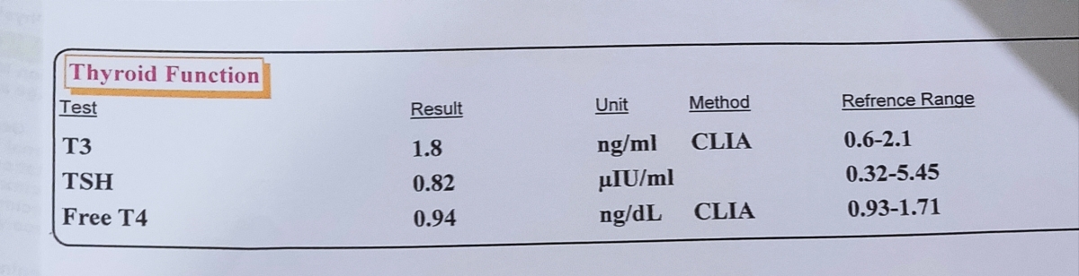 آزمایش تیروئیدم که قبلا عددش 6 بود لوکسین 100 روزی یه دونه جمعه ها نصفش رو مصرف میکنم آزمایش تیروئیدم که قبلا عددش 6 بود لوکسین 100 روزی یه دونه جمعه ها نصفش رو مصرف میکنم