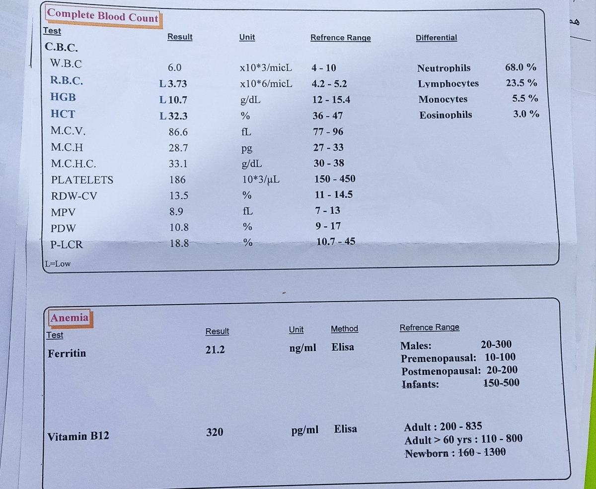 آزمایش برا آهن که خودم انجام دادم سرگیجه داشتم خیلی آزمایش برا آهن که خودم انجام دادم سرگیجه داشتم خیلی