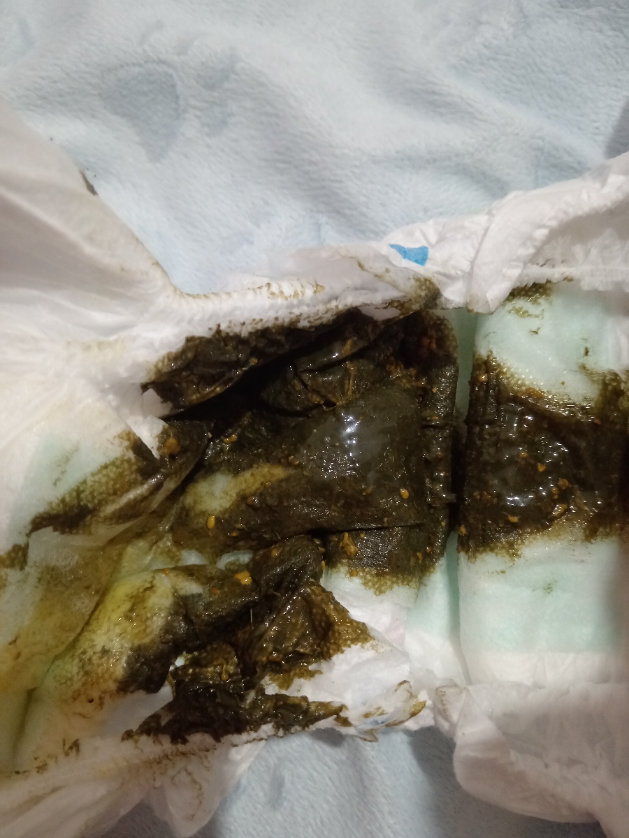 مدفوع کودک 2 ماهه (عکس) مدفوع کودک 2 ماهه (عکس)