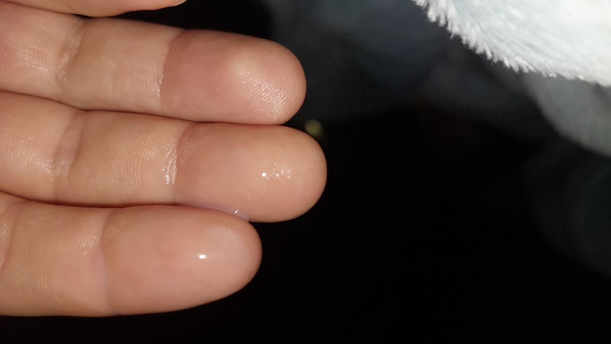 ترشح زیاد بعد از حمام