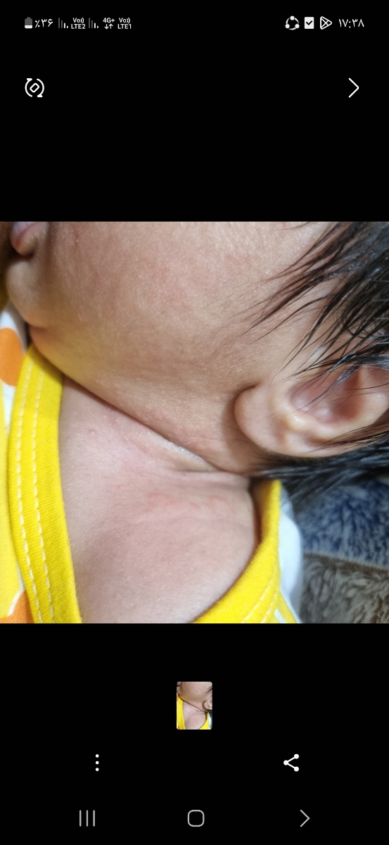 نگاه پوست صورت و گردن پسر منم ریخته بود بیرون نگاه پوست صورت و گردن پسر منم ریخته بود بیرون