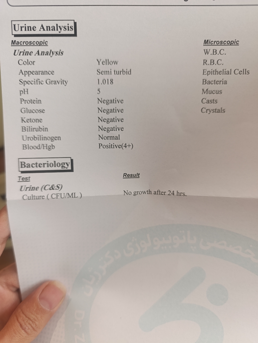 سوزش قبل و بعد ادرار