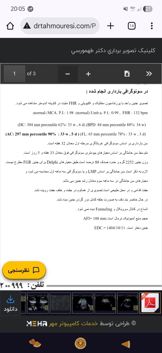 ۱۴ آبان ۱۴ آبان