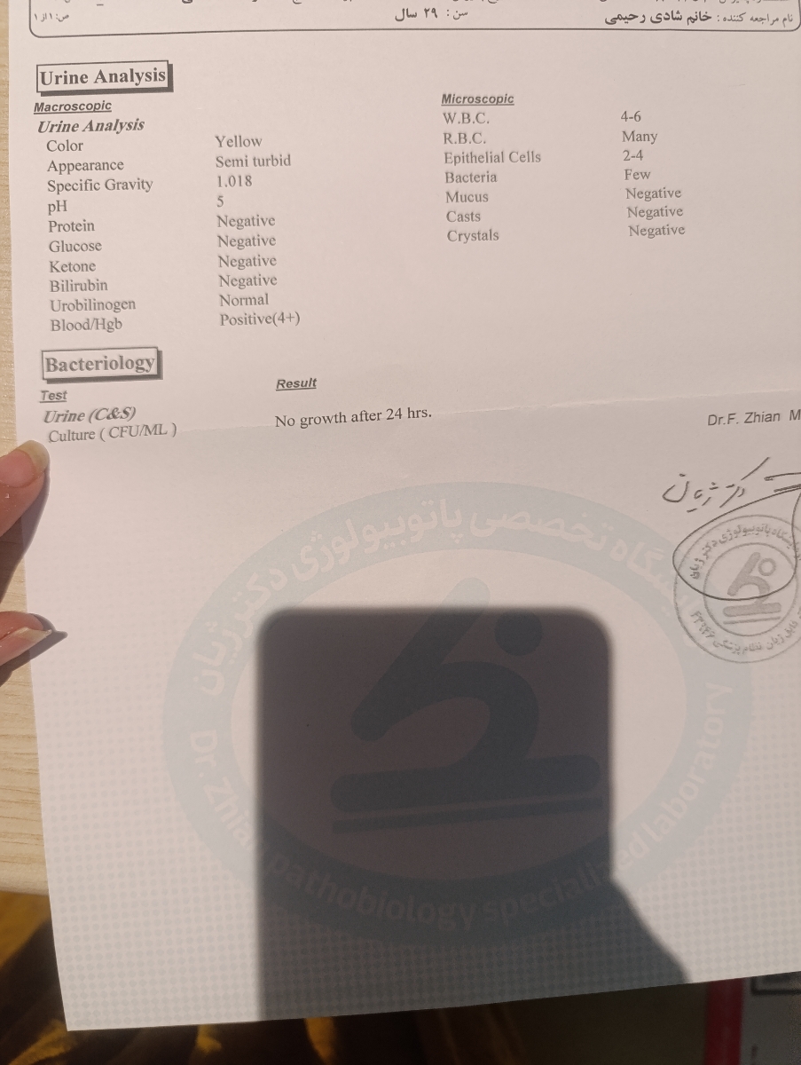 سوزش قبل و بعد ادرار