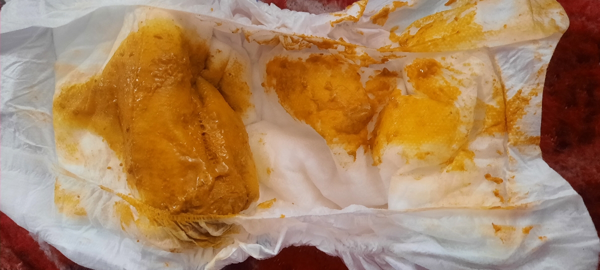 استفراغ خلطی بعد از خوردن شیر استفراغ خلطی بعد از خوردن شیر