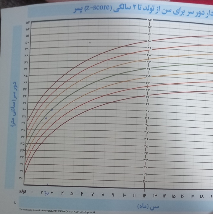 عرق زیاد سر نوزاد عرق زیاد سر نوزاد