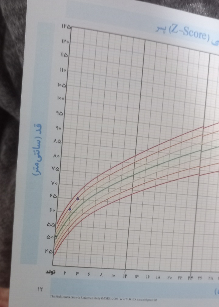 عرق زیاد سر نوزاد عرق زیاد سر نوزاد