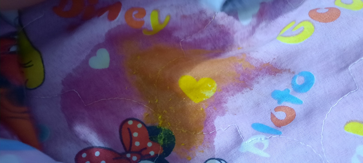 استفراغ خلطی بعد از خوردن شیر استفراغ خلطی بعد از خوردن شیر