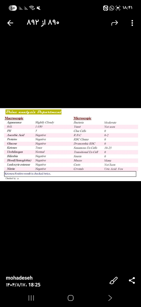ازمایش جواب کبد خون