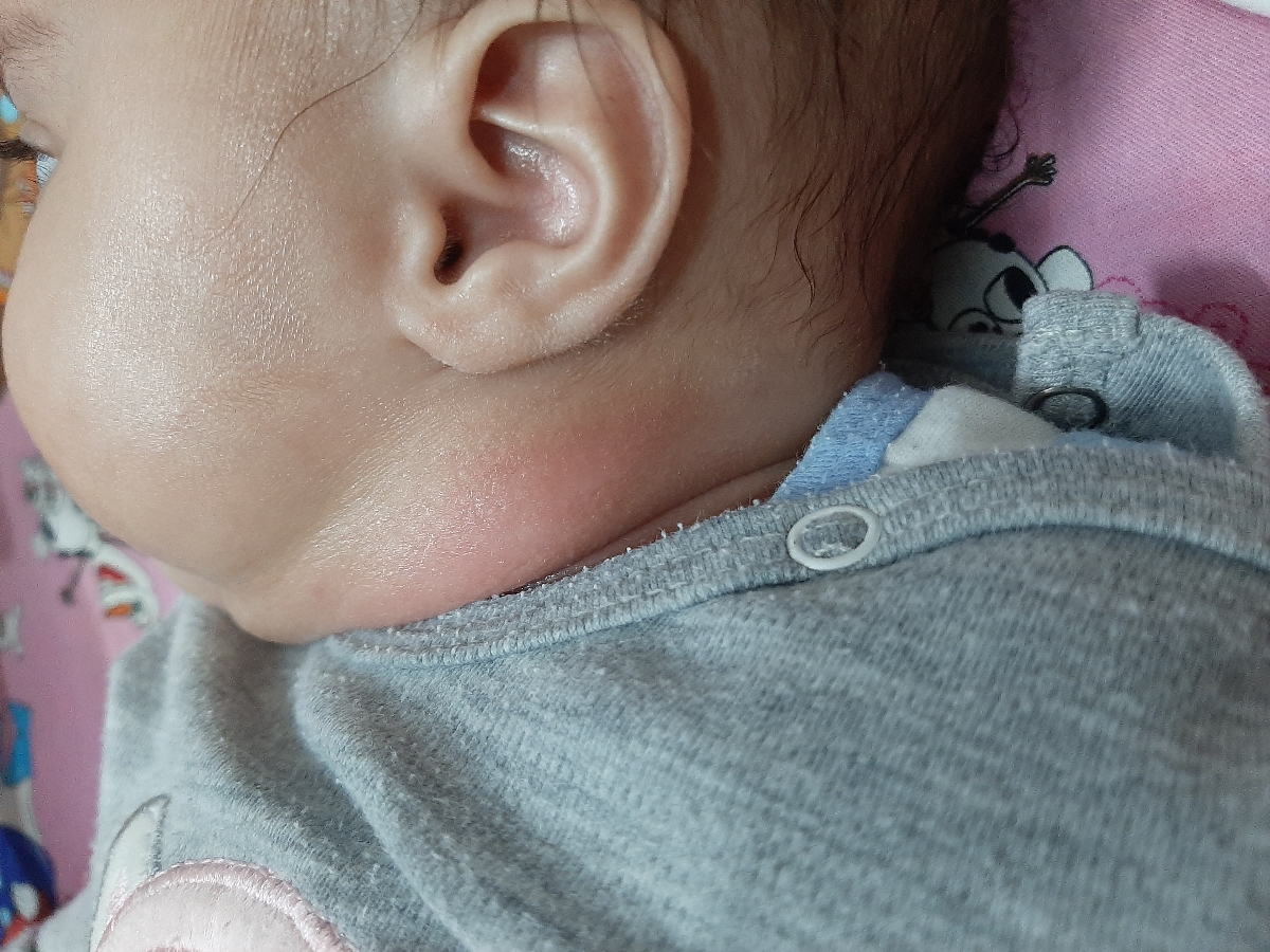 پوست نوزادم قرمز شده چیکار کنم ؟