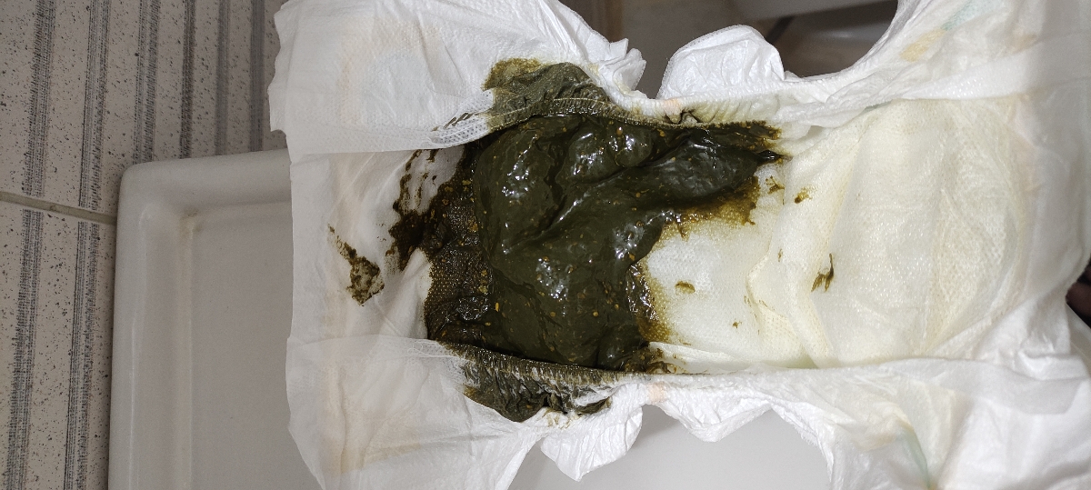 دکتر جان با عرض معذرت...این هم پوشک الان هست
به نظرم یه کمی سفت شده... دکتر جان با عرض معذرت...این هم پوشک الان هست
به نظرم یه کمی سفت شده...