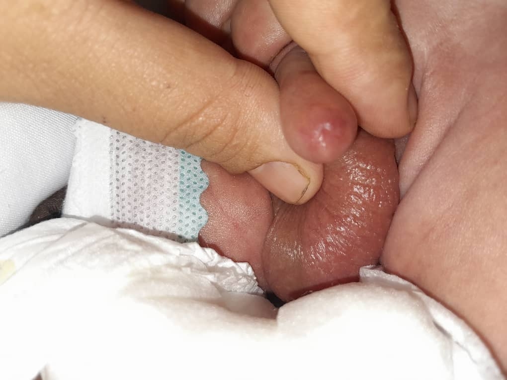 سلام ادرار نکردن نوزاد ۱۵ روزه ممنون میشم دکتر اوما جواب بدین سلام ادرار نکردن نوزاد ۱۵ روزه ممنون میشم دکتر اوما جواب بدین