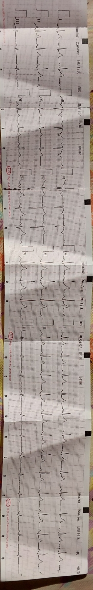 اورژانسی احساس تنگی نفس و درد توقفسه سینه