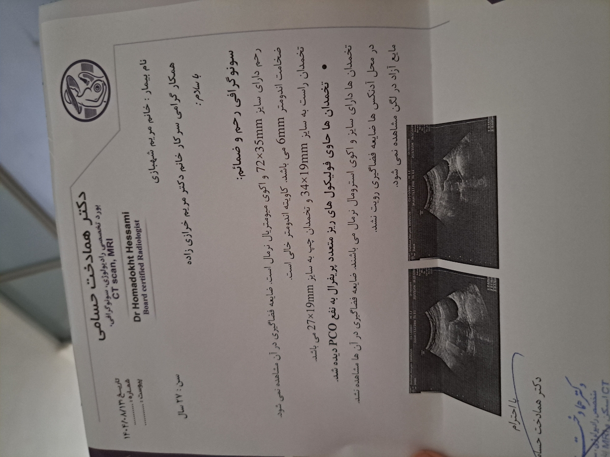 خونریزی زیاد پریودی بعد از سزارین