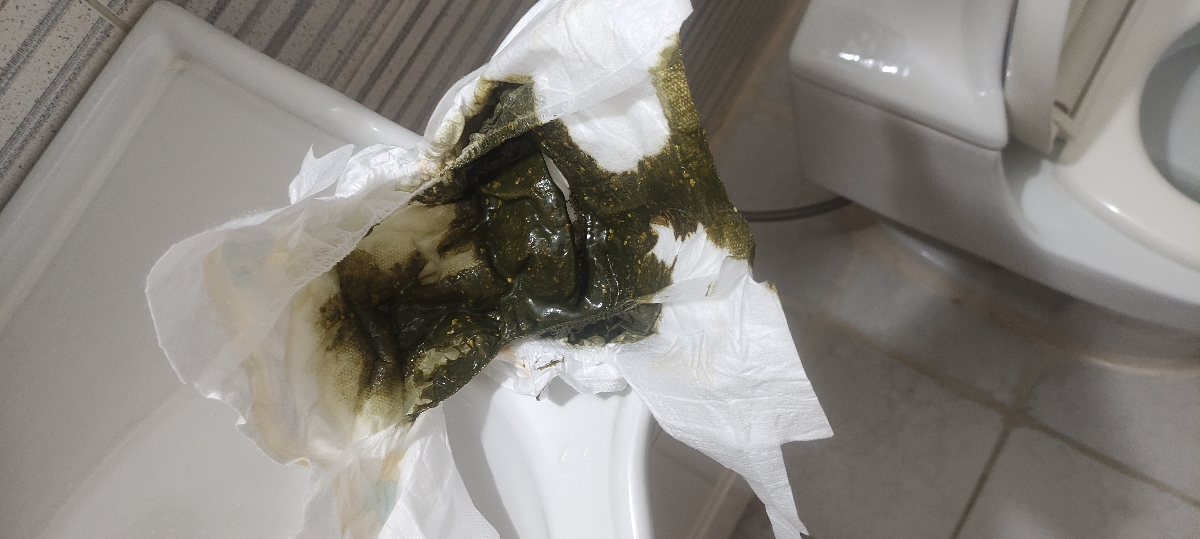 ❌مدفوع شل و سبز نوزاد ۵۳ روزه...❌ ❌مدفوع شل و سبز نوزاد ۵۳ روزه...❌