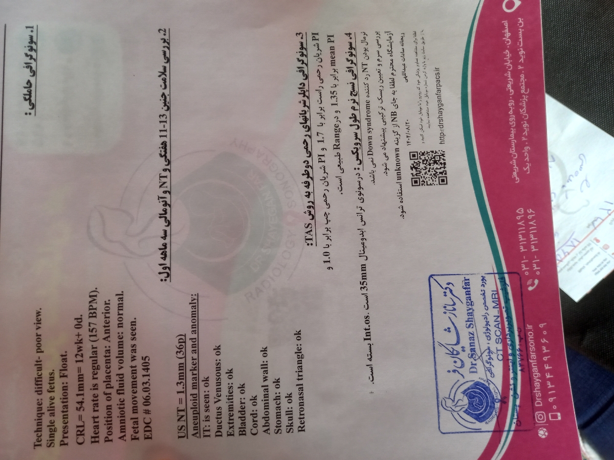 تفسیر سونو ان تی