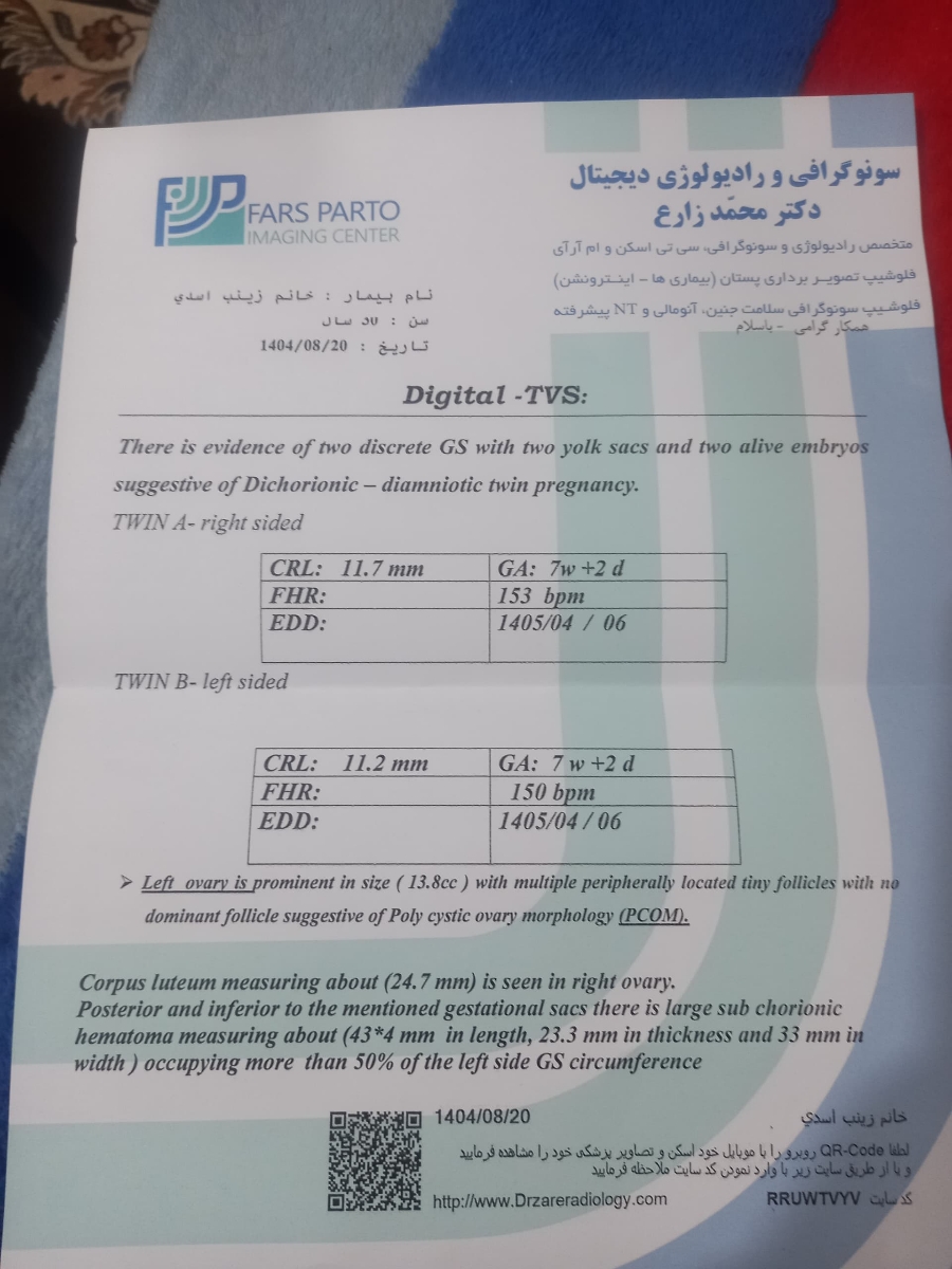 دوقلویی و هماتوم نسبتا زیاد