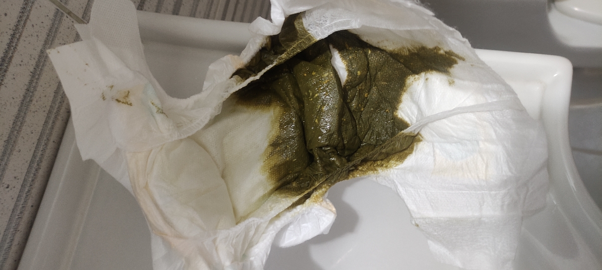 ❌مدفوع شل و سبز نوزاد ۵۳ روزه...❌ ❌مدفوع شل و سبز نوزاد ۵۳ روزه...❌