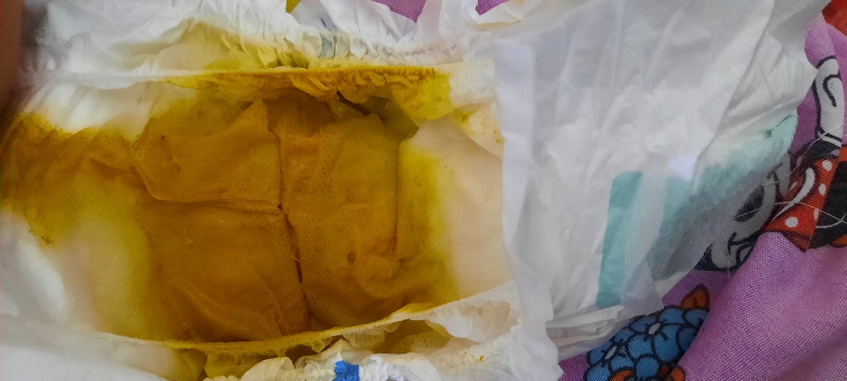 دلپیچه و زور زدن در طول روز،