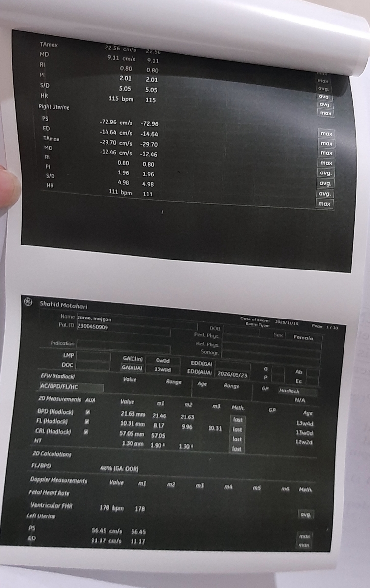 تفسیر و بررسی سونو انتی تفسیر و بررسی سونو انتی