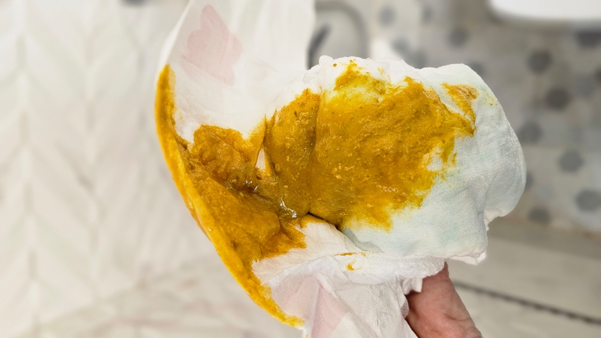 رفلاکس نوزاد یا حساسیت رفلاکس نوزاد یا حساسیت