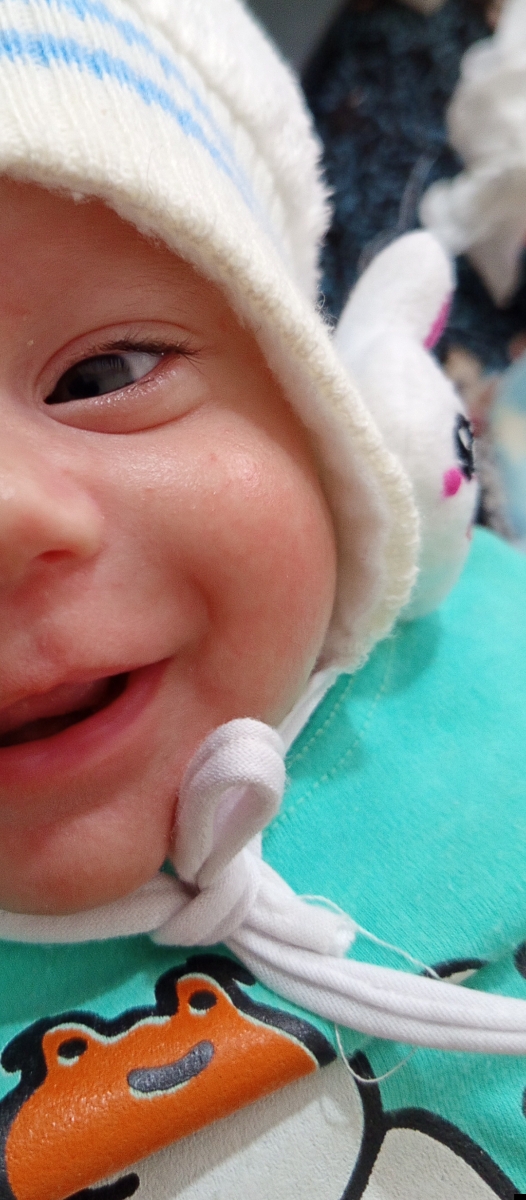 سلام خانم دکتر خوبین بچه من دو ماهشه صورتش دونه زده سلام خانم دکتر خوبین بچه من دو ماهشه صورتش دونه زده