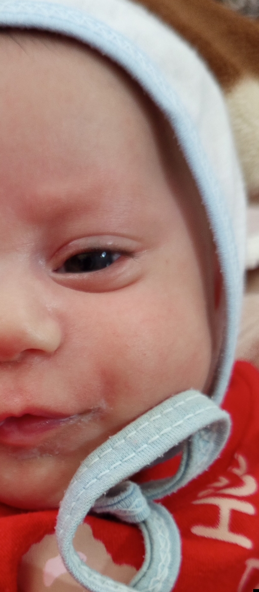 این عکسش قبل هردو حمومه ک صورتش رو با شامپو فیروز بشورم 🤐 اصلا دونه نداشت، سرشم تو موهاش جوش دیدم یعنی از شامپو فیروزه ؟ این عکسش قبل هردو حمومه ک صورتش رو با شامپو فیروز بشورم 🤐 اصلا دونه نداشت، سرشم تو موهاش جوش دیدم یعنی از شامپو فیروزه ؟