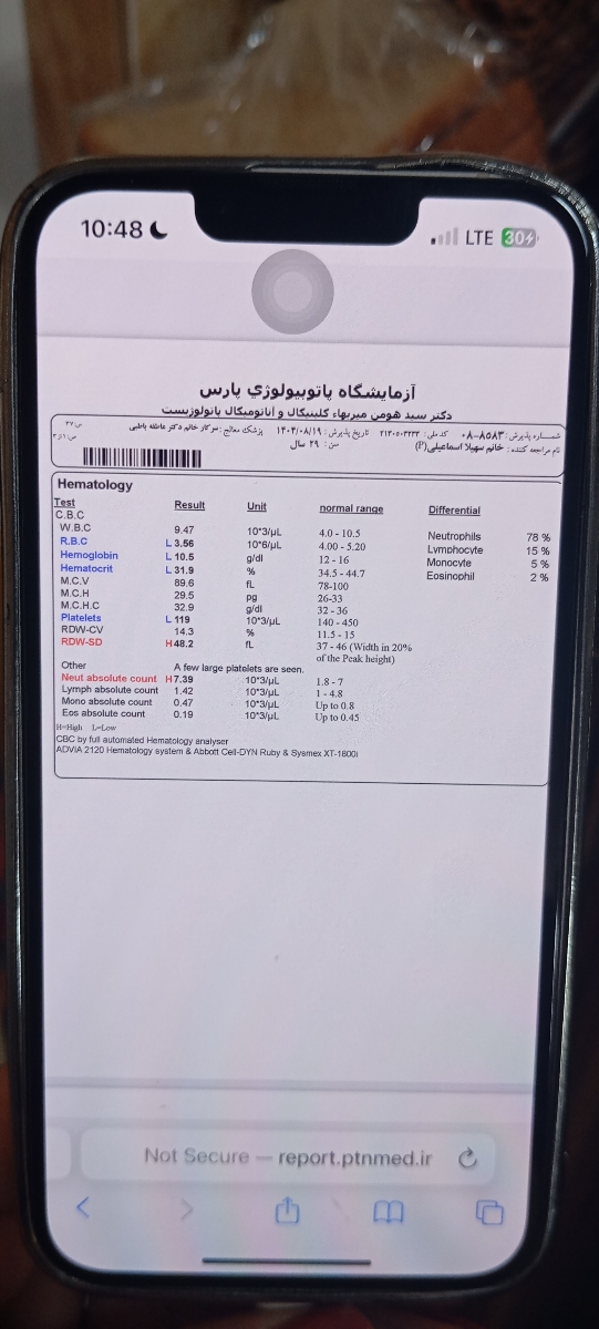 خانم دکتر تفسیر ازمایش