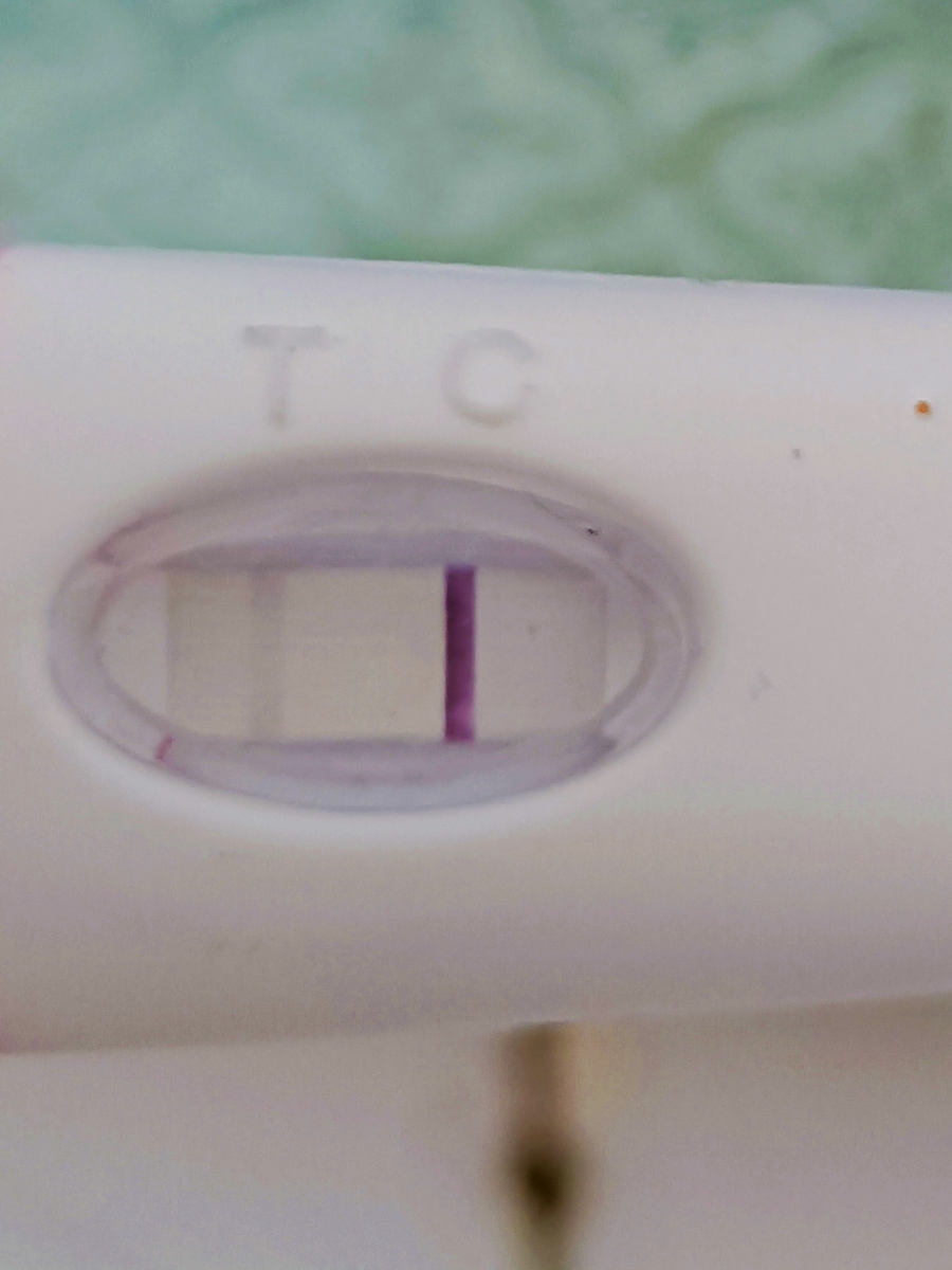 تفسیر. سونوگرافی با توجه به بیبی چک مثبت آزمایش منفی