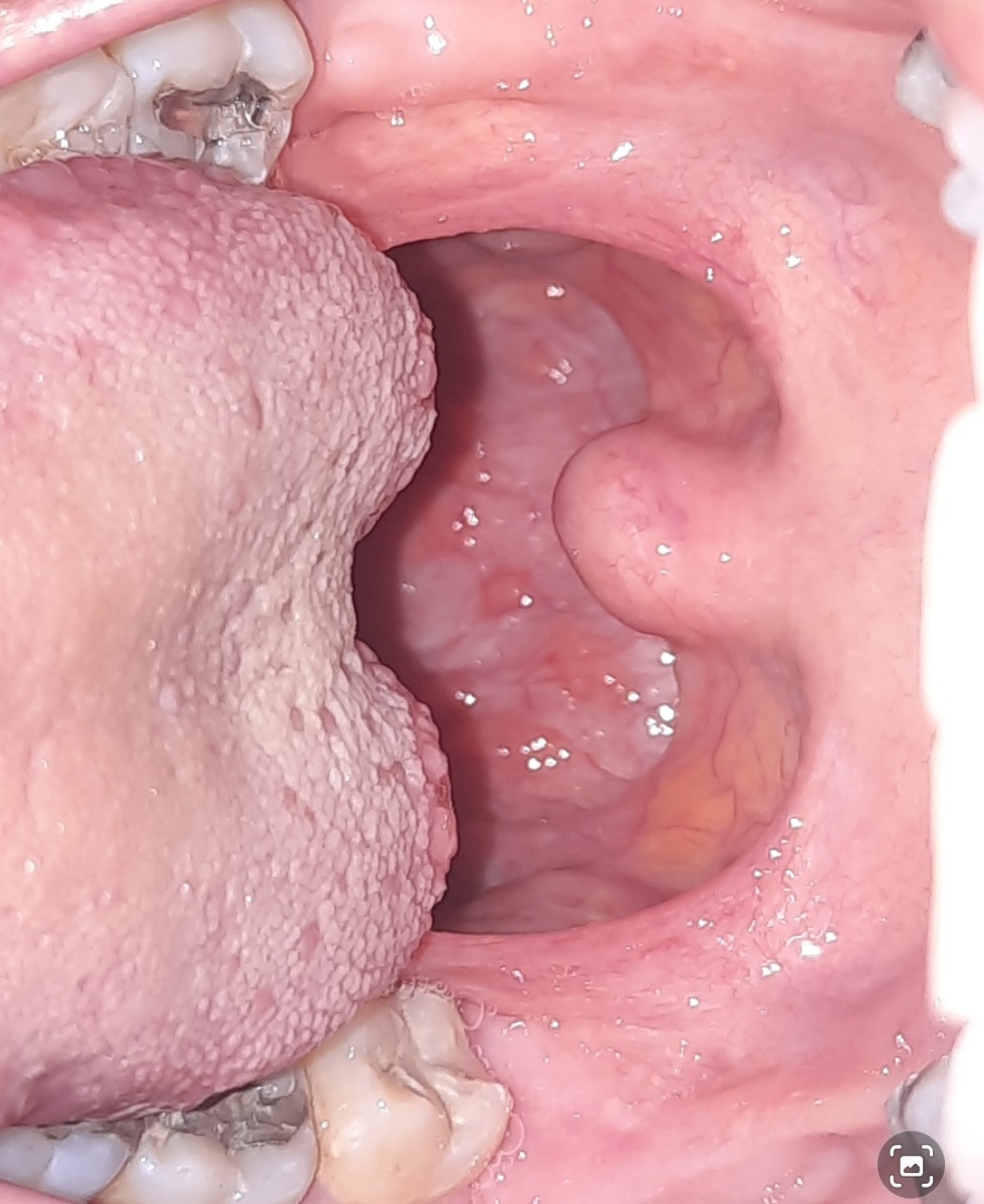 این عکس و دیروز گرفتم نمیدونم واضح هست یا نه این عکس و دیروز گرفتم نمیدونم واضح هست یا نه