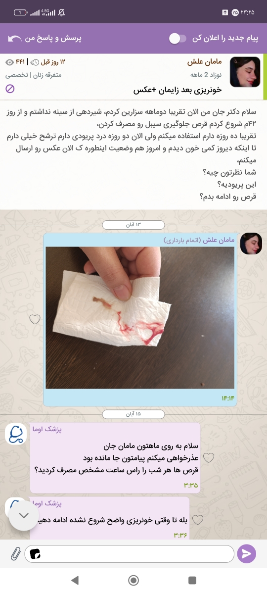 پریودی ۱۴ روزه بعد زایمان پریودی ۱۴ روزه بعد زایمان