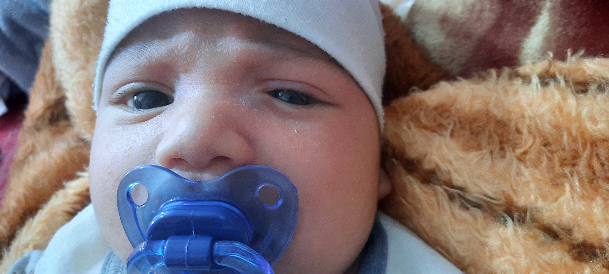 عروق خونی چشم نوزاد عروق خونی چشم نوزاد