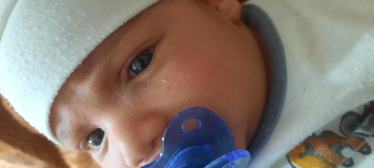 عروق خونی چشم نوزاد عروق خونی چشم نوزاد