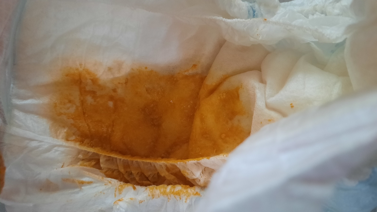 مدفوع خلط دار نوزاد ❌حاوی عکس ❌